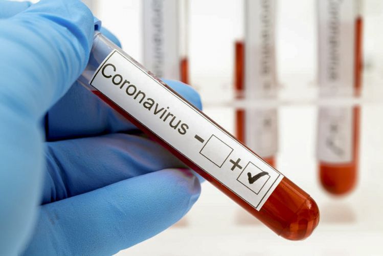 Riflessioni in libertà all’epoca del coronavirus